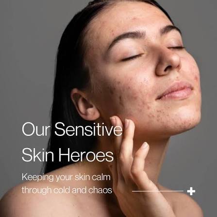 senstive skin image
